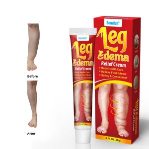 Hot Sale Krim Bengkak Leg Edema Cream Bengkak Dan Kesakitan Ubat Surut Bengkak Kaki Membantu Melancarkan Darah Kurangkan