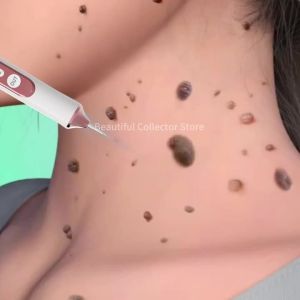 Skin Tag Remover Plasma Pen Wart Mole Freckle Dark Spot Removal Pen Electric Beauty Skin Care Device Plasma Pen for Skin Tag Removal Electric Beauty Skin Care Device