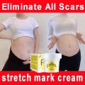 Stretch mark cream scar remover cream Stretch Marks Remover Skin Repair Cream 50g Special for Pregnancy Postpartum Care Remove pregnancy scars. 
