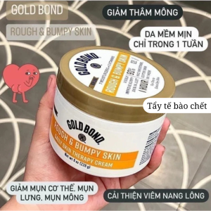 Kem dưỡng Body GOLD BOND ULTIMATE ROUGH BUMPY SKIN chính hãng của Mỹ 226g
