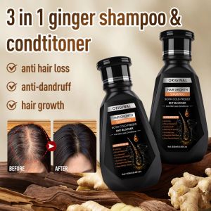 SCCS~Buy 1 Get4 250ml Ginger Hair Growth Shampoo Anti Dandruff Itchy Scalp Strengthen Hair Follicles