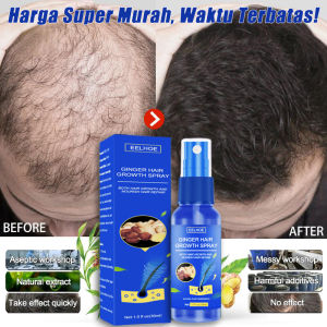 EELHOE Spray Penumbuh Rambut Cepat - Obat Kebotakan Pria BPOM Anti Rontok Parah & Regenerasi Folikel