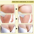 Vova Strechmark cream krim penghilang stretchmark stretchmark selulit. 