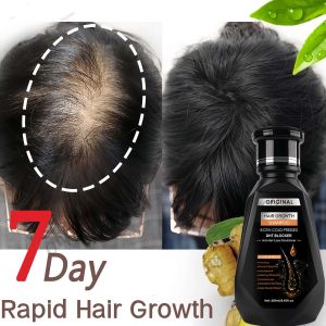 250ML Ginger Shampoo 7 Day Fast Regrowth Hair Thick Anti-Hair Loss Anti-Dandruff Anti-itching Repair Damaged Hair Minoxidil Shampoo Treatment Hair Care