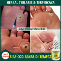 Obat Mata Ikan di Telapak Kaki, Obat Mata Ikan di Kaki & Tangan, Salep untuk Menghilangkan Mata Ikan, Obat Oles Mata Ikan / Kutil / Kapalan / Clavus, Penghilang Benjolan Kecil Herbal, Infeksi Jamur Kulit, dgn Obat Tetes Mata Ikan Propolis SM [BISA COD]. 