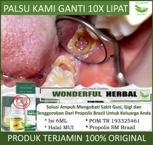 Obat Tetes Kumur Sakit Gigi Gusi Bengkak Gigi Berlubang Karang Gigi Gusi Berdarah Gusi Bolong Infeksi Gusi Radang Tenggorokan Sariawan Perih Bau Mulut - Cocok Untuk Anak Anak & Dewasa Aman Tanpa Efek Samping - Bagus Dengan Propolis SM Original