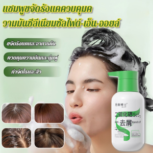 เรียบเนียนและนุ่มขึ้น แชมพู ครีมแชมพู โภชนาการ เพิ่มเส้นผม ดูแลหนังศีรษะ อ่อน ติดทนนาน แชมพู ถุงผมที่ใส แชมพูขจัดรังแค รวย ต้านเชื้อแบคทีเรียและกําจัดไร ควบคุมความมัน