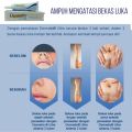 Dermatix Ultra Cream 15gr Obat Penghilang Bekas Luka Salep Bekas Luka. 