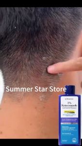 BUY 1 TAKE 1 ORGANIC ANTI-DANDRUFF SHAMPOO NOURISHING REPAIRING DAMAGED HAIR