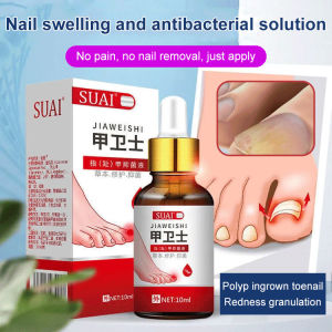 指甲消腫抑制液Nail Swelling And Antibacterial Solution Onychomycosis Care Solution