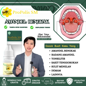 Obat Amandel Bengkak Tonsilitis Radang Amandel Sakit Tenggorokan Mengempeskan Amandel Bengkak Anak Dan Dewasa - Propolis SM