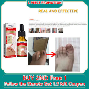 ubat kuku rosak ingrown toenail nail fungus treatment甲沟炎嵌甲灰指甲ubat kuku cekam toenail corrector paronychia pain relief