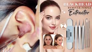 Grade Blackhead Extraction Tool Kit - Blackhead Remover Tool Comedones Extractor Acne Removal Kit for Blemish - Whitehead Popping - 7 Pcs Set Removing for Nose Face Tools (Content 7-Piece Set)