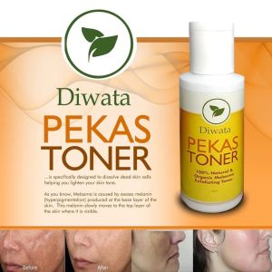 Pekas Toner 100% Natural and Organic Melasma Exfoliating Toner 60ml Radiant Skin Repair