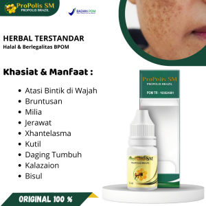 Propolis SM Obat Oles Bintik Hitam Di Wajah Bruntusan Milia Jerawat Xhantelasma Kutil Di Wajah Daging Tumbuh Kalazion Di Kelopak Mata Bisul Bekas Luka Di Wajah Ruam Merah Borok Di Kepala Korengan Psoriasis Ketombe Berkerak