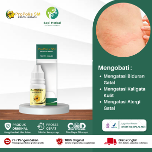 Obat Gatal Seluruh Badan Obat Biduran dan gatal gatal Obat Alergi Kulit Gatal Bentol Obat Biduran Di Tangan Dan Badan Propolis SM