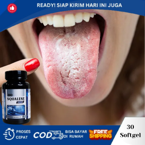 Obat Penghilang Lidah Putih Berjamur Obat Lidah Pecah Pecah Obat Tetes Lidah Putih Obat Lidah Mati Rasa Obat Lidah Terasa Pahit Obat Sariawan Lidah Tak Kunjung Sembuh Obat Benjolan DiLidah Dengan Bio Squalene