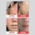 Real Derma - Medical Cream MD ครีมรักษาผิวแห้ง ผิวอักเสบ รอยแผลเป็น 50g. 