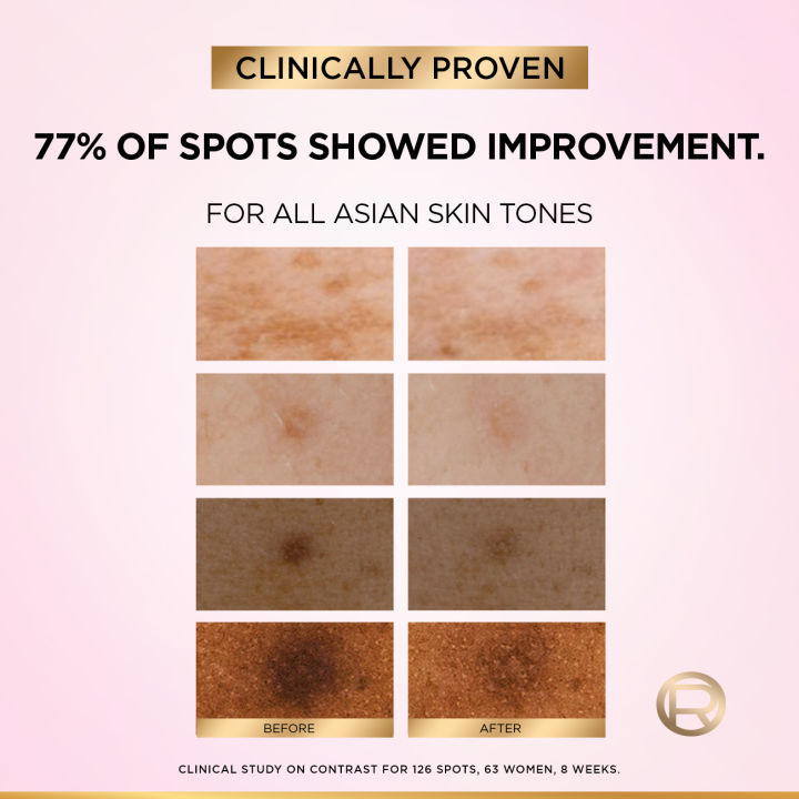 LOr%C3%A9al%20Paris%20Bright%208%25%20%5BMelasyl%20%E2%84%A2+%20Glycolic%20+%20Niacinamide%5D%20Face%20Serum%20for%20Dark%20Spot%20&%20Brightening%2015ml%20-%20Image%206