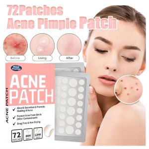 【MY Girl】72 PCS Salicylic Pimple Patch Blemish Treatment Skin Care Acne Repair Waterproof Acne Patch