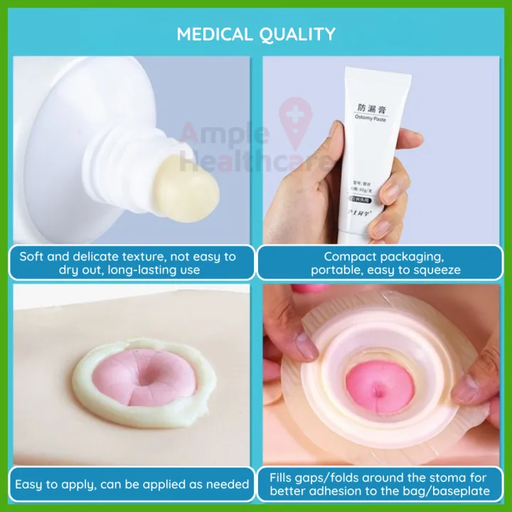 Ostomy%20Leak-Proof%20Skin%20Barrier%20Paste%2060g%20%E2%80%93%20Colorectal%20Stoma%20Bag%20Care,%20Anti-Leak%20Sealant%20for%20Ostomy/Drainage/Collection%20Bags%20-%20Image%203