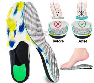 1 pair of orthopaedic insolesOrthoticsFlat feetHealthy insolesShoe insolesArch support padsPlantar fasciitisFoot careSports running insoles for men and women