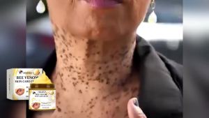 Houkea  Krim Perawatan Kulit Racun Lebah   Perawatan Kulit Lembut Kyu Mole Krim Pembersih Perawatan Kulit Halus