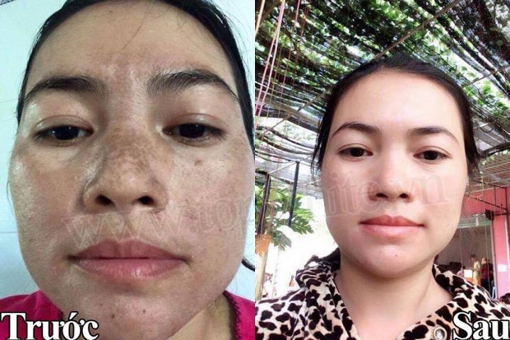 Kem%20Top%20White%20D1%20M%E1%BA%ABu%20M%E1%BB%9Bi%202021%20T%C3%A1i%20T%E1%BA%A1o%20M%E1%BA%A1nh%20Hi%E1%BB%87u%20Qu%E1%BA%A3%20G%E1%BA%A5p%205%20L%E1%BA%A7n%20D%C6%B0%E1%BB%A1ng%20Tr%E1%BA%AFng%20Da%20Tr%E1%BB%8B%20N%C3%A1m%20T%C3%A0n%20Nhang%20-%20Image%207