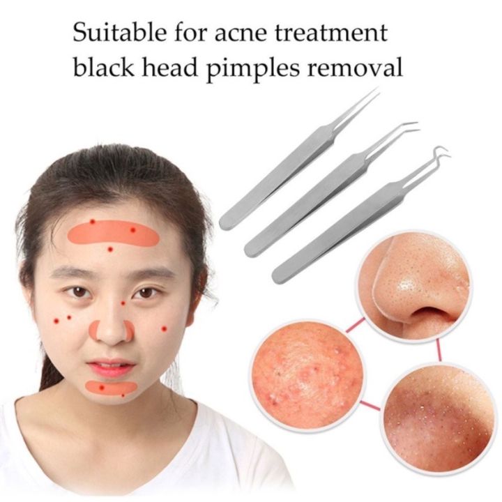 View of Acne & Blemish Treatments - Skin Care - 254 Products | Ulta Beauty