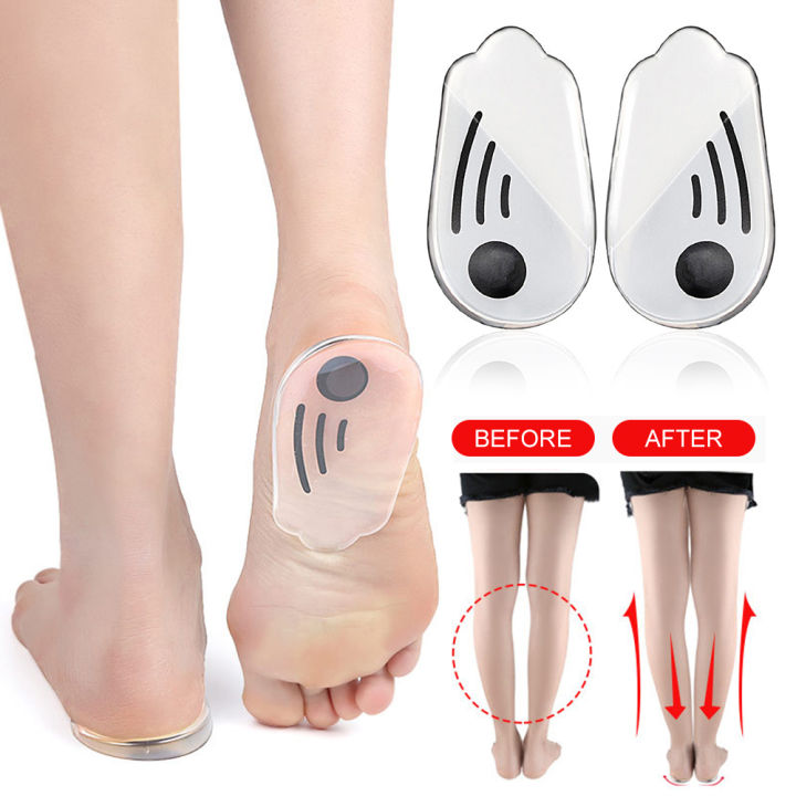 Royal Orthopedic Shoe Inserts with Stone for O/X Type Leg