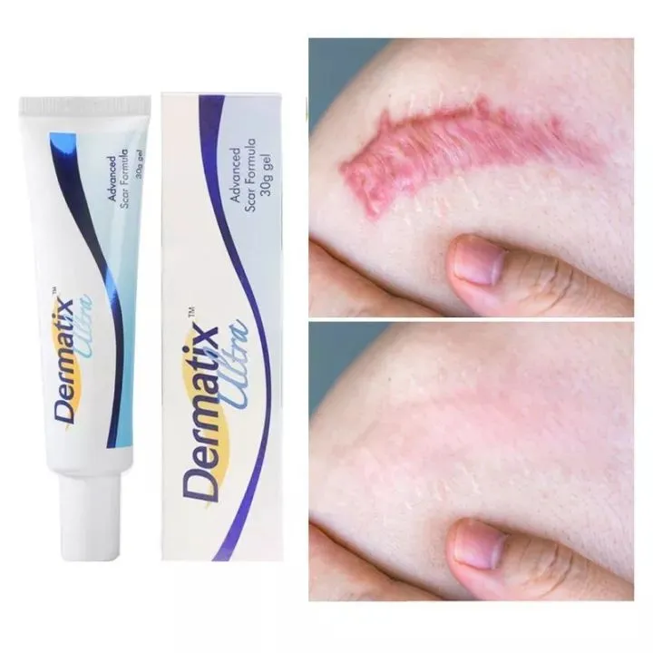 Dermatix Ultra Gel Kem Làm Mờ Sẹo Thâm, sẹo15g