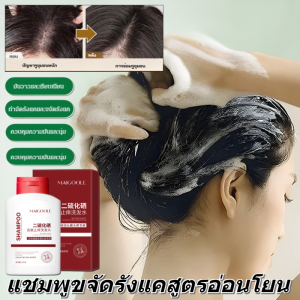 Anti Dandruff Shampoo แชมพูคุมมันกำจัดรังแค แชมพูขจัดรังแค คันหนังศีรษะ ผมมันเยิ้มรังแคใช้ดีกว่า
