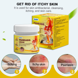 Eczema Cream Anti Itch Cream 30g Private Itching Eczema Cream Psoriasis Creams Dermatitis Itchy Skin Cream Herbal Anti Itch Cream Not Irritating Skin Bacteriostat For Adults And Kids