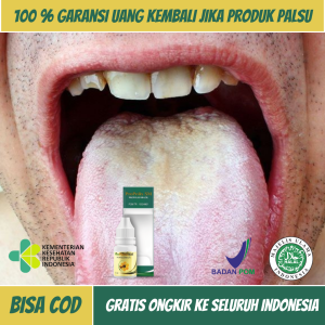Obat Radang Lidah Putih Obat Lidah Putih Berjamur Obat Herbal Radang Lidah Obat Lidah Putih Terasa Pahit Obat Bercak Putih di Lidah Anak dan Dewasa Obat Pembersih Jamur Di Lidah Obat Radang Lidah Mati Rasa Dengan Propolis SM