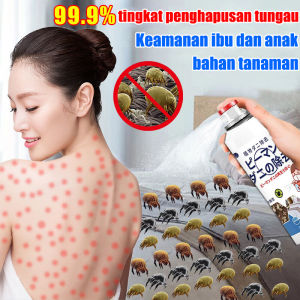 Hapus tungau dalam 1 detik YUESHUXIN Pembasmi Kutu Kasur 300ml 100% menghilangkan tungau dan bakteri pada sofa kasur pakaian mainan mewah 100 hari bebas tungau Aman dan tidak berbahaya(GUN KILLER Pembasmi kutu PEMBASMI KUTU SOFA Obat Pembasmi Kutu Kasur)