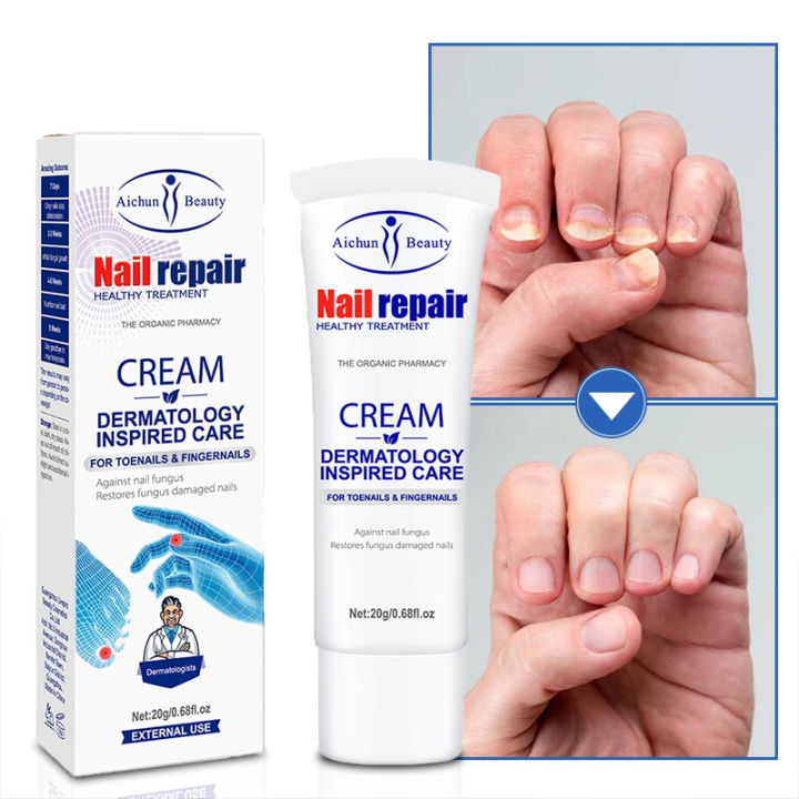 Antifungal Nail Treatment Cream 20g Fungal Nail Treatment Ointment