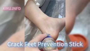 Crack Feet Stick with Moisturizing Balm for Dry Heels Daily Foot Care Essential