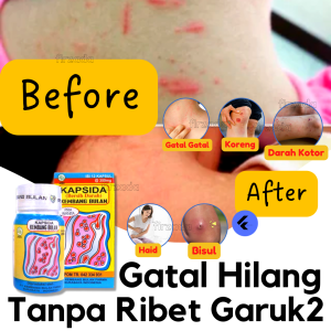Kapsida Obat Pembersih Darah Kotor Penghilang Gatal Kulit Seluruh Badan Pria Dan Wanita Permanen