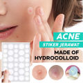 C.three 36Pcs Acne Patch Salicylic Cute Star Invisible Pimple Acne Remover Patch Sticker SkinCare Waterproof TOPITEM👍. 