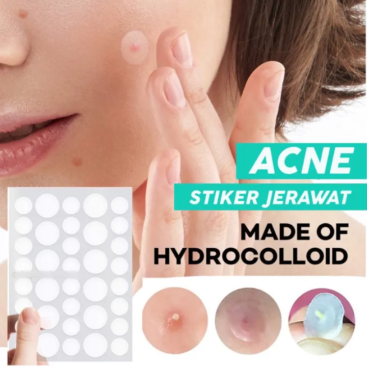 C.three%2036Pcs%20Acne%20Patch%20Salicylic%20Cute%20Star%20Invisible%20Pimple%20Acne%20Remover%20Patch%20Sticker%20SkinCare%20Waterproof%20TOPITEM%F0%9F%91%8D%20-%20Image%203