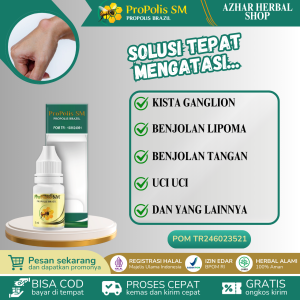 Proplis SM Obat Kista Ganglion Benjolan Di Tangan Penghancur Benjolan Lunak / Keras diTelapak Tangan