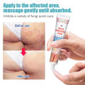 KanyeHB ointment for itchy skin and allergy 20g For the treatment of pruritic dermatitis,eczema, inner thigh skin diseases anti fungal cream Private itching cream Private Antibacterial Ointment Gamot sa kati kati sa balat cream anti itch cream for private. 