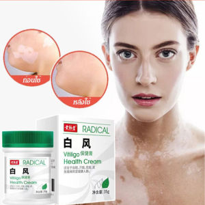 vivistyle Vitiligo Health Cream ไวท์สปอตรีมูฟเวอร์ 35g