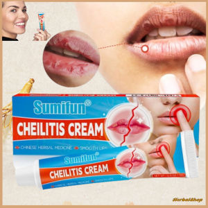Cheilitis Treatment Cream Sumifun Wrinkle Inflammation