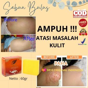 SABUN GATAL KULIT PALING AMPUH UNTUK DEWASA DAN ANAK BAYI BALITA / SABUN BULUS SR12