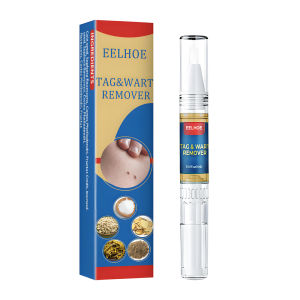 EELHOE Wart Remover Pen Krim Penghilang Lalat Krim Penghilang Kutil Mudah Dibawa Untuk Semua Kulit Krim Penghilang KutilWart Removal Cream