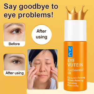 VC Lutein Eye Oil Lightweight Anti Wrinkle Essence Oil Dark Circle Removal And Firming Eye Bags Eye Essence