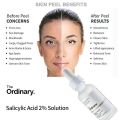 The Ordinary Acne Remover Serum Set - Salicylic Acid 2% Solution BHA+Azelaic Acid Suspension 10% Improve Acne Prone Skin Removes Dead Skin Cells 30ml*2. 