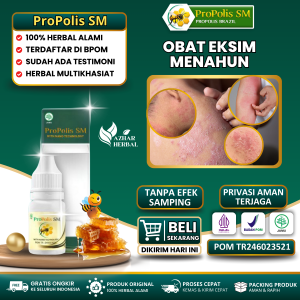 Obat Eksim Menahun Eksim Kering Eksim Basah Salep Eksim Gatal Kulit Eksim Eksim Parah Eksim Kering dan Basah Menahun Gatal Gatal Seluruh Badan Kulit Kering Bersisik Koreng Kurap Panu Psoriasis - Propolis SM Brazil Asli Original Bpom Halal Mui