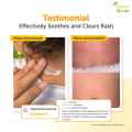 Mama’s Choice Baby Diaper Cream | Rash Cream | Nappy Rash Ointment | Baby Anti-Itch. 